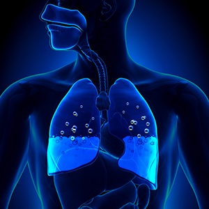 Pulmonary Edema treatment in Vijayawada