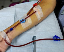 Is dialysis life saving treatment